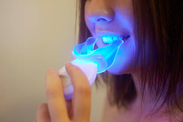 BLANQUEADOR DE DIENTES DE LUZ ULTRAVIOLETA