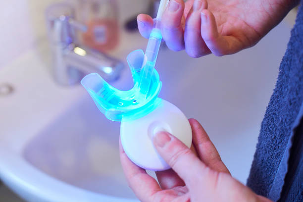 BLANQUEADOR DE DIENTES DE LUZ ULTRAVIOLETA